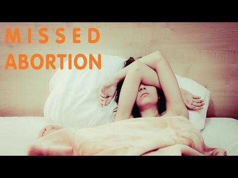 MA - Missed Abortion | AltforMamma MA - Missed Abortion | AltforMamma