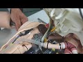 SimMan 3G PLUS - How to Replace Arms