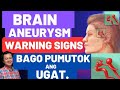 Brain Aneurysm: Warning Signs Bago Pumutok ang Ugat. -By Doc Willie Ong (Internist and Cardiologist)