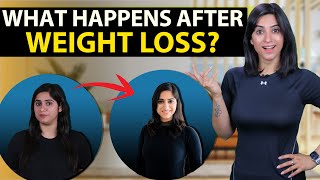 What happens after WEIGHT LOSS ? | By GunjanShouts