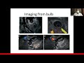 08 how i do imaging of bile duct dr manoj sahu