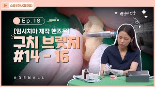 [스탭세미나 핸즈온] ep18. 임시치아제작 - 구치 브릿지 #14-16