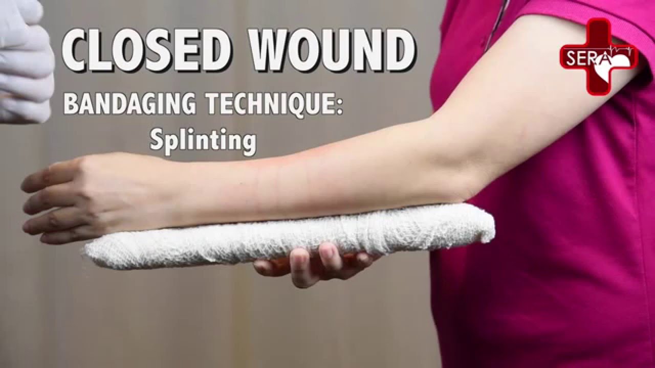 Closed Wound - Splinting | Singapore Emergency Responder Academy, First ...