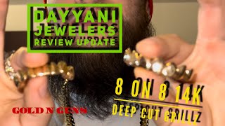 Dayyani jewelers 8 on 8 14k yellow gold grillz update After 1 year of wear