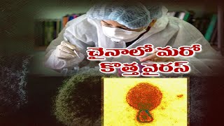 New Virus in China : Langya Virus Found in China Causing Liver, Kidney Failure