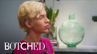 Sugar Baby Wants Huge Lips 2x Bigger \u0026 Permanent! | Botched | E!