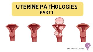 Uterine Pathologies Part 1