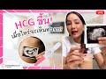 HCG ขึ้น! เมื่อไหร่จะเห็นทารก?