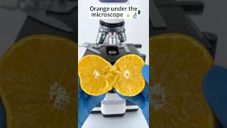Orange A Hidden World Under the Microscope – Bacteria Close-Up #microscope #science