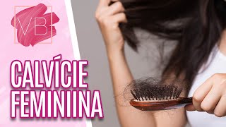 Precauções e tratamentos para calvície feminina - Você Bonita (16/03/20)