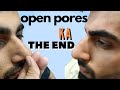 How I Treated My Open Pores At Home | Get Smooth Clear Skin | Mridul Madhok