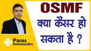 OSMF क्या मुँह का कैंसर हो सकता है ? | Oral Fibrosis | मुँह का कैंसर कैसे बनता है ? | Muh ka cancer