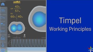 Timpel - Working Principles