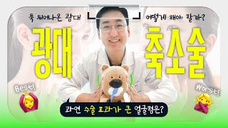 광대축소술의 효과가 큰 얼굴형은? 광대축소술의 모든 것!