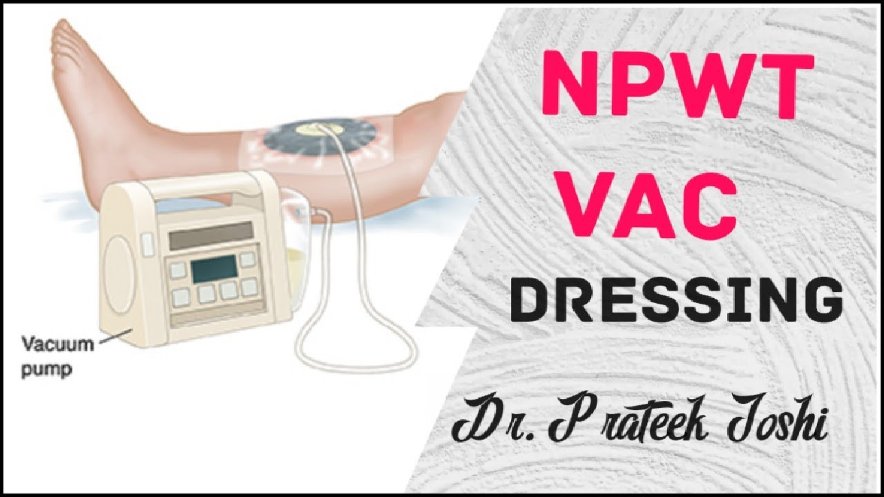 Negative Pressure Wound Therapy | Vaccum Assisted Closure | VAC ...