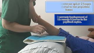 Short Leg Posterior Mold Splinting