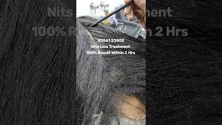 Nits lice treatment 100% result within 2 hrs Chennai doorstep available #headliceremoval#headlice