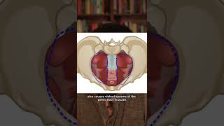 Doctor Explains RANDOM Sharp Butt Pain!