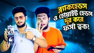 ব্ল্যাক মাস্ক দিয়ে ব্ল্যাকহেডস ও হোয়াইট হেডস দূর করুন🔥*১০০%*| Blackheads,Whiteheads 100% Home Remedy