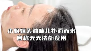 小姐姐头油味儿直接扑面而来，自称天天洗都没用