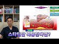 고지혈증 약 스타틴 vs. 오메가3 vs. 에제티미브