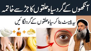 How To Remove Dark Circles | Dark Circle Khatam Karne Ka Tarika | Dark Circle Remove Dr Sharafat Ali