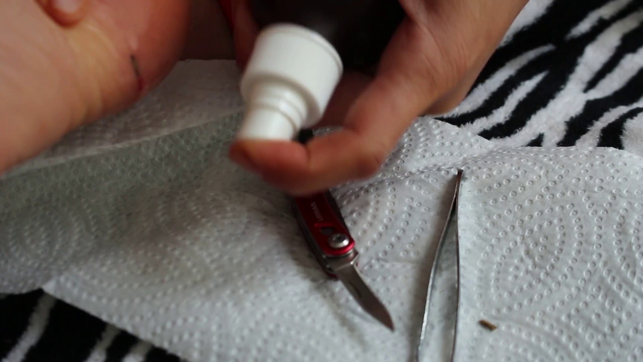 Removing Splinter Part 2 Youtube