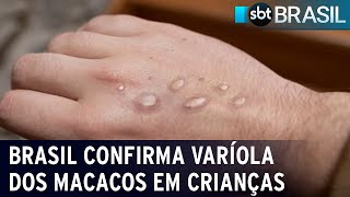 Brasil registra três primeiros casos de varíola dos macacos em crianças | SBT Brasil (29/07/22)