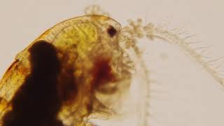 Freshwater Cyclopoid copepod with ciliate growth