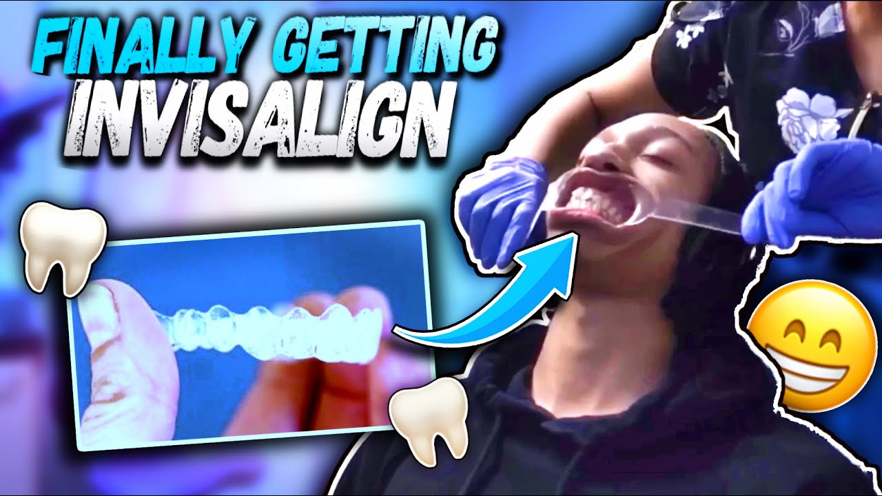 Finally Getting Invisalign Youtube