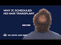 Why JC Scheduled His Hair Transplant at We Grow Hair Indy