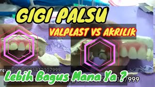 Review Gigi Palsu Valplast VS Gigi Palsu Akrilik