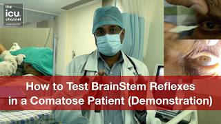 Demonstration of How to Test Brainstem Function via Cranial Nerves in Comatose Patient on Ventilator