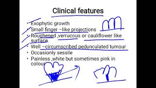 squamous papilloma