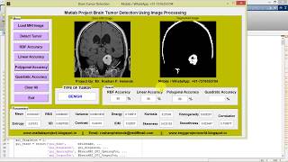 Brain Tumor Detection Using Image Processing Matlab Project with Source Code || IEEE Based Project