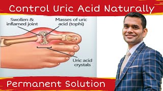 Natural way to decrease Uric Acid | Permanent Treatment Of Increased Uric Acid