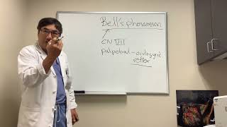 Bell’s phenomenon in NOP