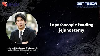 22ndMESDA: Laparoscopic feeding jejunostomy by Assist.Prof.Bandhuphat Chakrabandhu