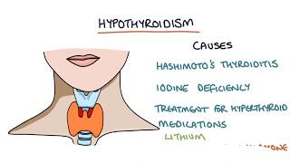 Hypothyroidism and Hashimoto's Thyroiditis: Visual Explanation for Students