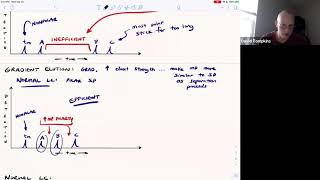 Separations: LC General Elution Problem \u0026 Isocratic vs. Gradient Elution