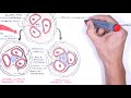 nephritic syndrome classification pathophysiology treatment rpgn anca immune complex