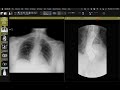 STR Cardiothoracic Case Webinar 2/16/2023