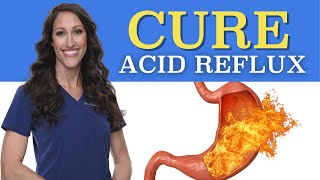 How to CURE GERD Permanently | Natural Treatment for Acid Reflux