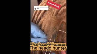 Man with dreads that sleeps on the beach finds a CRITTER living in his hair😨😱😩😳😳