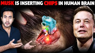 Neuralink HUMAN TRIALS Have Begun! ELON MUSK is Inserting Computer Chips Inside HUMAN BRAINS