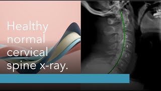 Platinum Chiropractic Erina X-ray Explanation