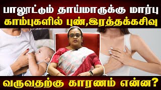 தாய்ப்பால் கொடுக்கும் போது  முலைக்காம்பில் புண் வருமா? | How to treat sore nipples for breastfeeding