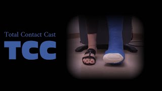 TCC - Total Contact Cast - Application \u0026 Walking with it