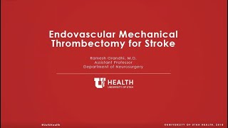 Endovascular Mechanical Thrombectomy for Stroke