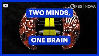 Your Brain Has Two Minds | NOVA | PBS